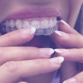 retainer